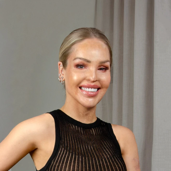 Katie Piper on Conversations of Inspiration